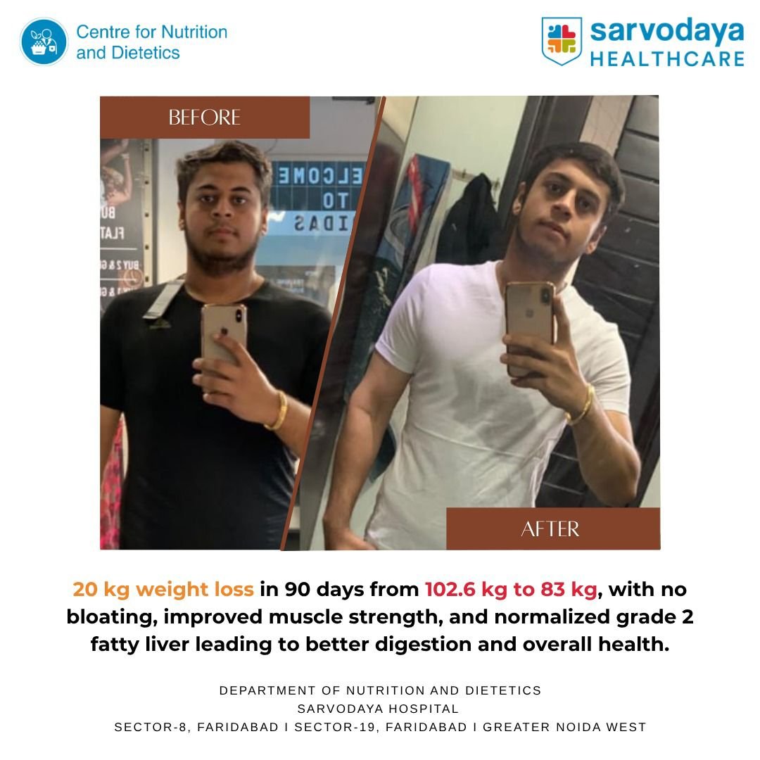 20kg weight loss